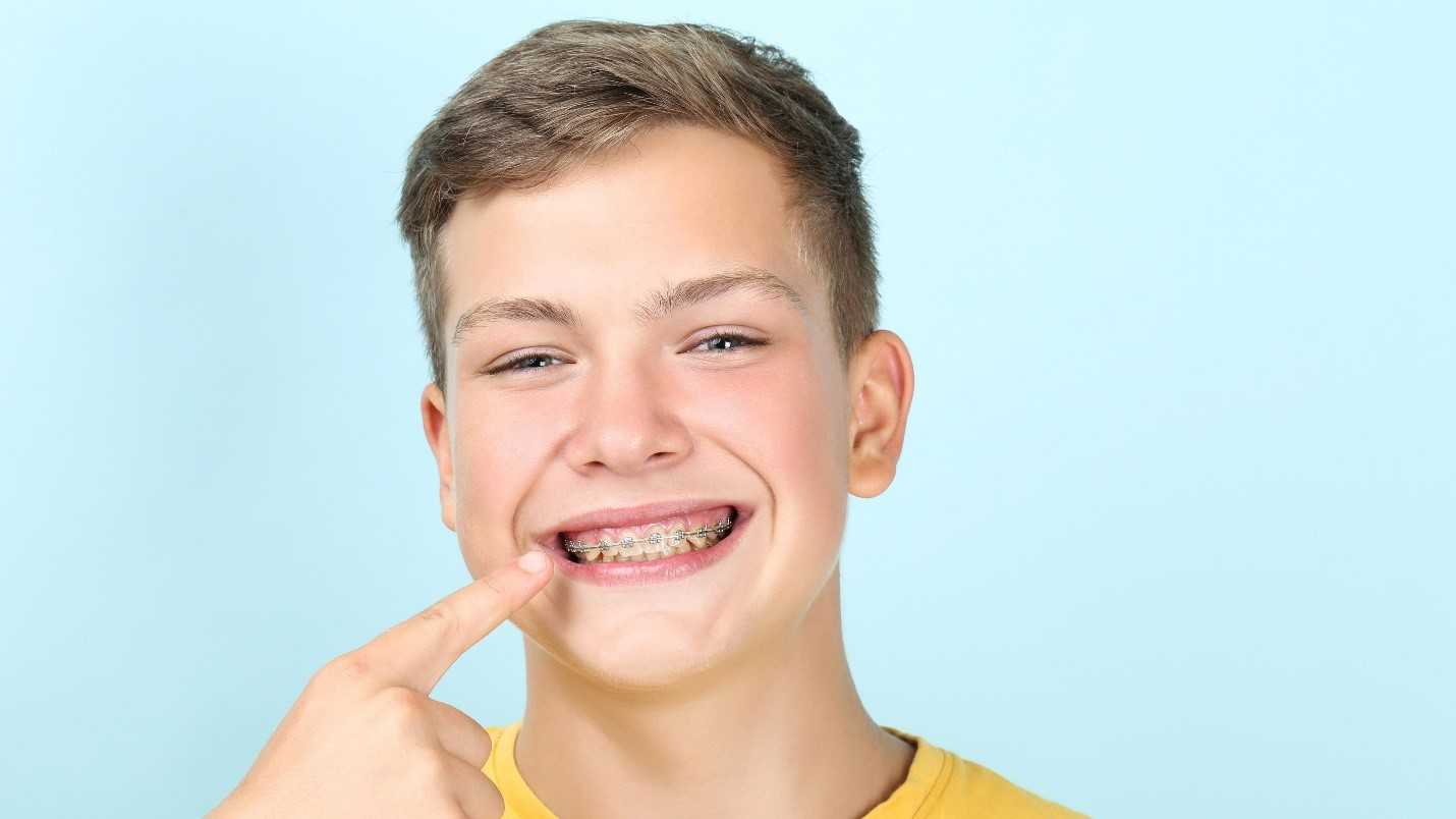 When To Start Orthodontic Treatment