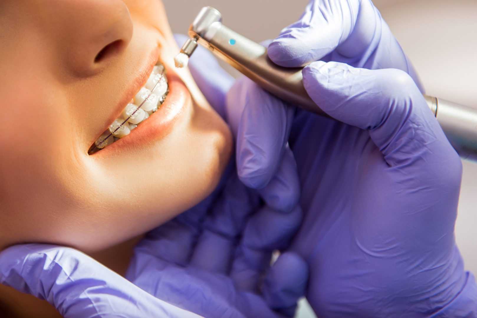 dental hygienist cleaning teeth