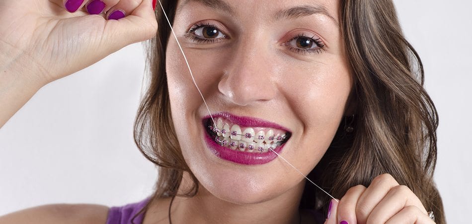 how to floss with braces