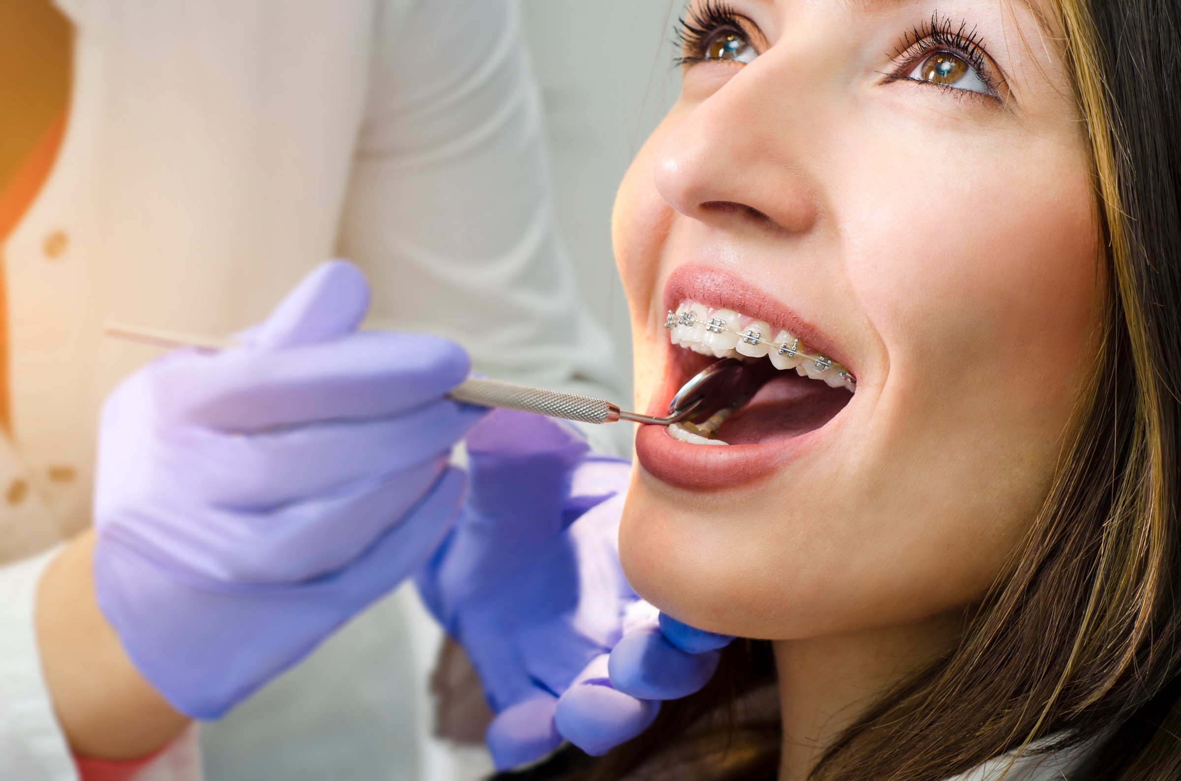 Fry Orthodontics metal braces patient